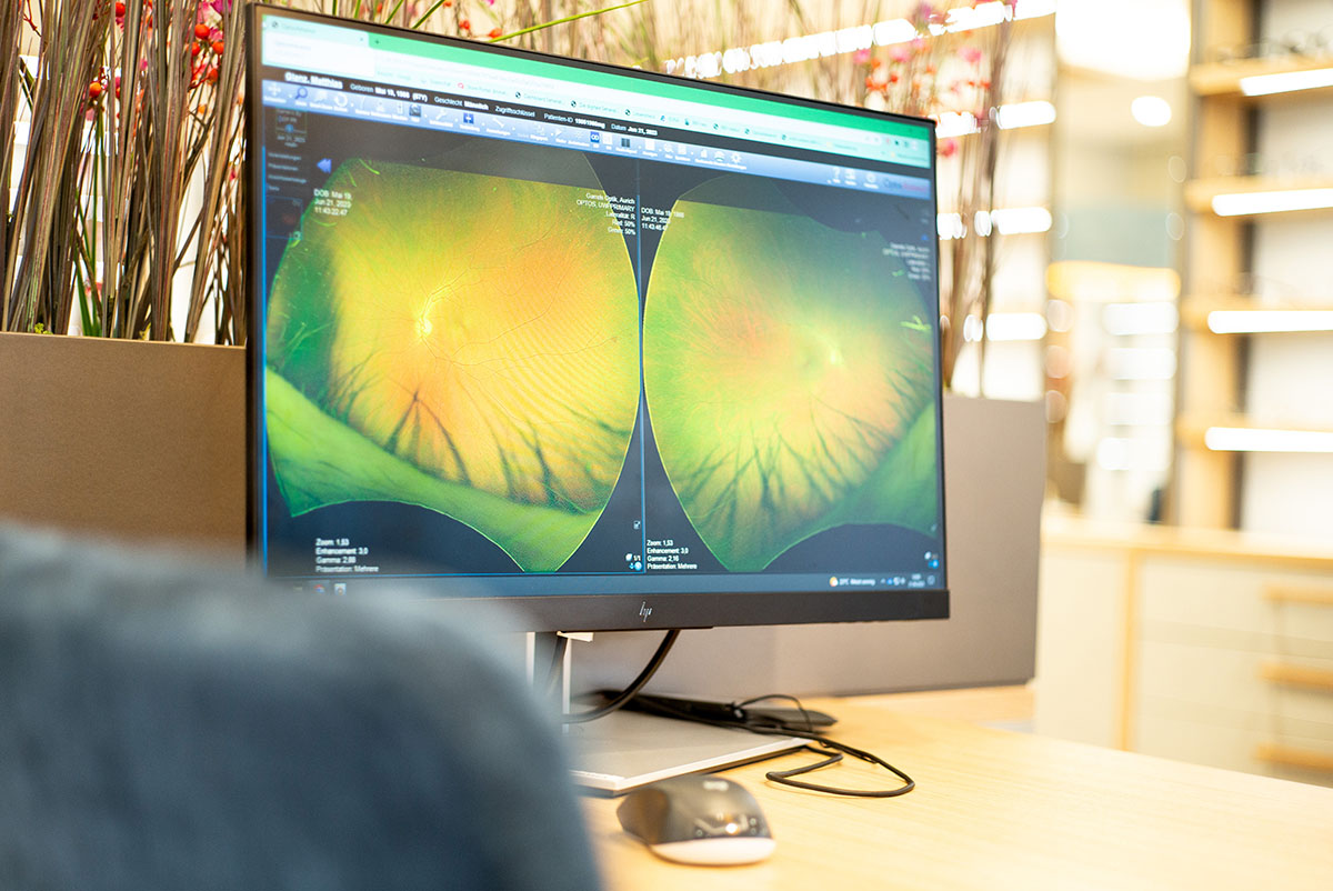 Monitor des Gesundheitscheck "Augen" bei Garrels zeigt eine Nahaufnahme der Augäpfel